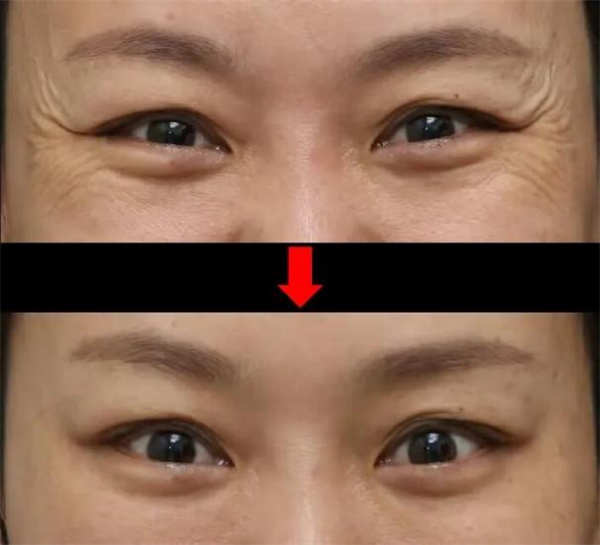 图片 20.jpg 图片 20.jpg